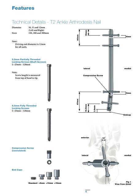 T2 Ankle Arthrodesis Nail - Stryker