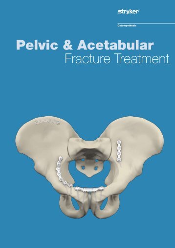 stryker osteosynthesis email Have a question talk to a specialist call 1-800-739-7706 contact us now. stryker osteosynthesis email Have a question talk to a specialist call 1-800-739-7706 contact us now.