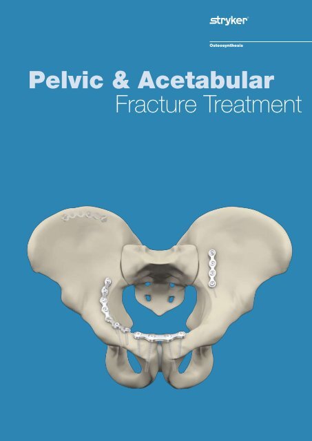 Pelvic & Acetabular Fracture Treatment - Stryker