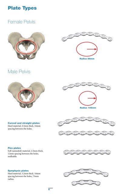 Pelvic & Acetabular Fracture Treatment - Stryker