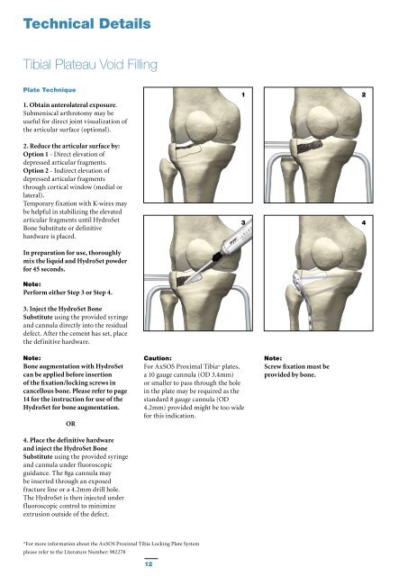 HydroSet Brochure - Stryker