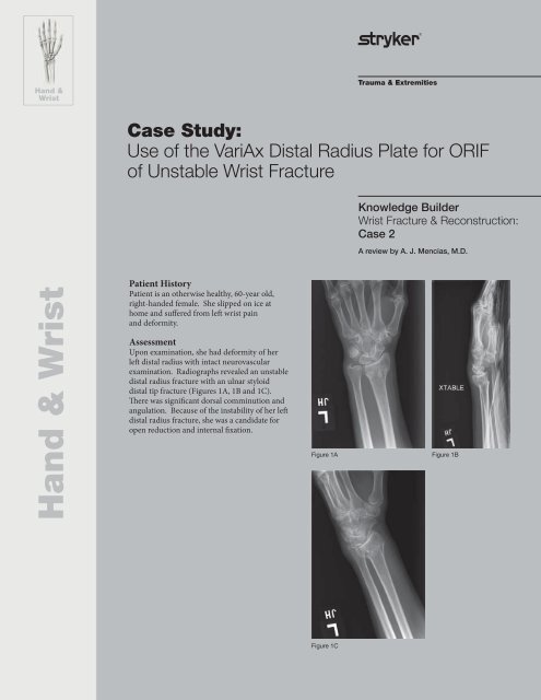 fracture case study scribd