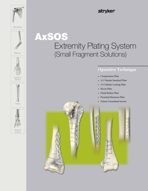 AxSOS Extremity Plating System Operative Technique - Stryker