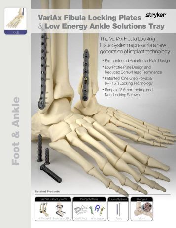 hand osteosynthesis Stryker hand plating system read more about locking, stryker, screws, tissue, compression and products. hand osteosynthesis Stryker hand plating system read more about locking, stryker, screws, tissue, compression and products.