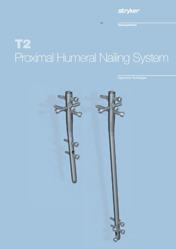 Recon nail vs cephalomedullary nail image