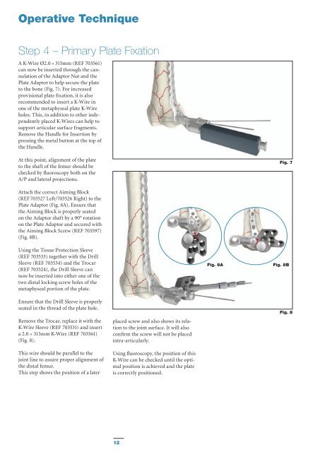 AxSOS Targeting System Distal Lateral Femur Operative - Stryker