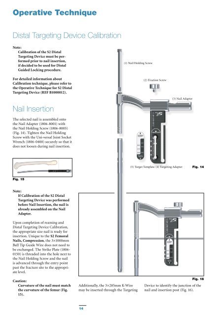 S2 Femoral Nail Compression Operative Technique - Stryker