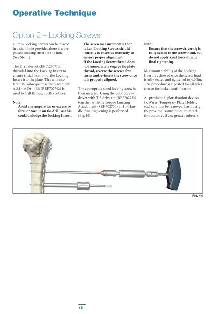 AxSOS Proximal Humerus TS Operative Technique - Stryker