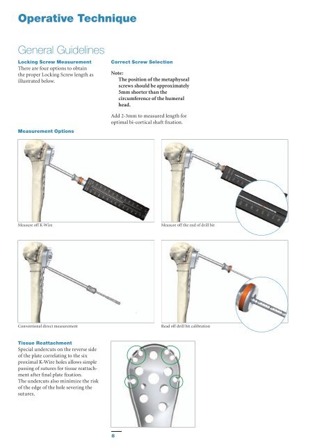 AxSOS Proximal Humerus TS Operative Technique - Stryker