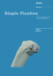 Staple Fixation System - Stryker