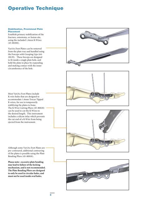 Variax foot locking plate system - Stryker