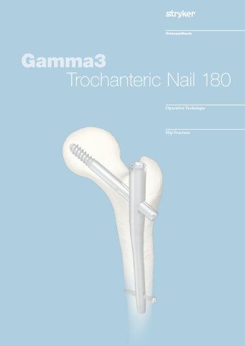 Gamma3 Trochanteric Nail 180 - Stryker