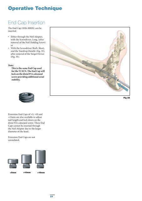 T2 Ankle Arthrodesis Nail - Stryker