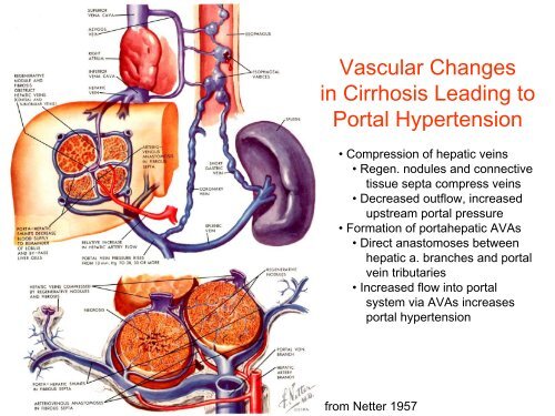 Clinical anatomy in the context of portal hypertension.