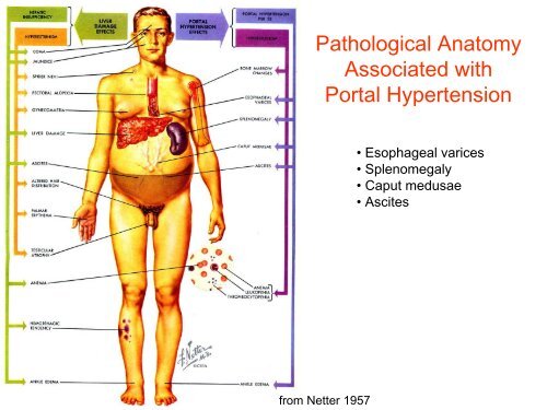 Clinical anatomy in the context of portal hypertension.