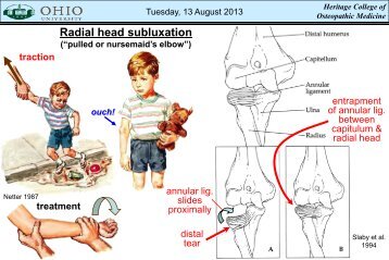 Scaphoid Fracture & Avascular Necrosis - Ohio University College of ...