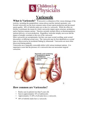 Varicocele - OU Medicine