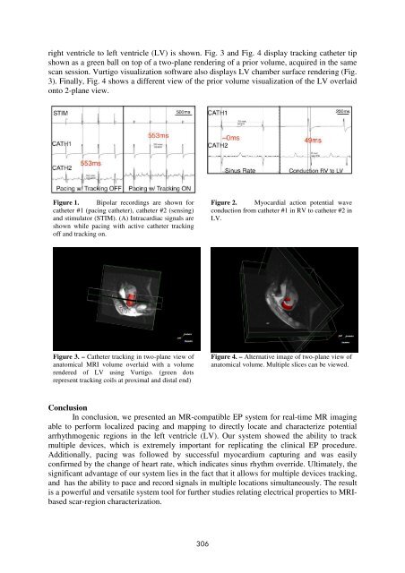 8th Interventional MRI Symposium Book of Abstracts - Otto-von ...
