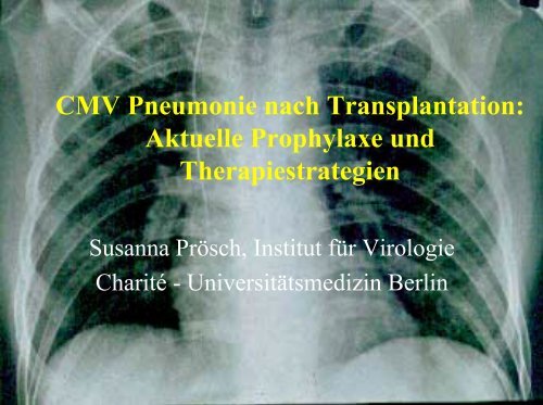 CMV Pneumonie nach Transplantation: Aktuelle Prophylaxe und ...