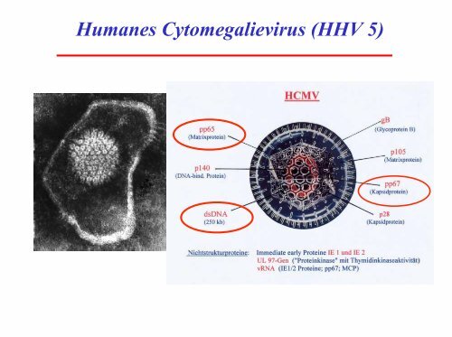 CMV Pneumonie nach Transplantation: Aktuelle Prophylaxe und ...