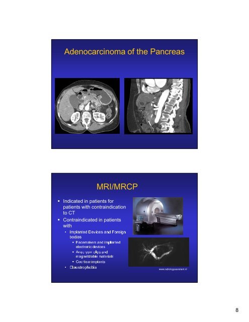 Pancreatic Cancer: Current Diagnostic Tools Clinical Presentation