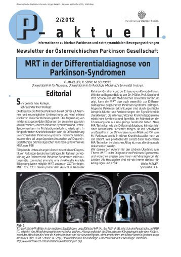 02/2012 - MRT in der Differentialdiagnose von Parkinson-Syndromen