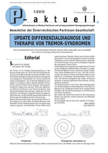 update differenzialdiagnose und therapie von tremor-syndromen