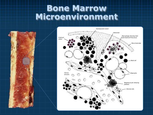 Bone Marrow Pathology