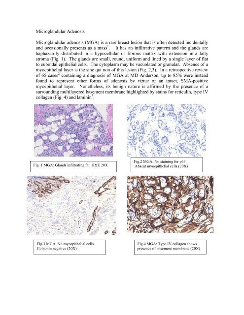 article by Drs. Joshi and Ahmad (May 2011) - Pathology Outlines