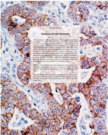 CHAPTER 3 Tumours of the Stomach - Pathology Outlines