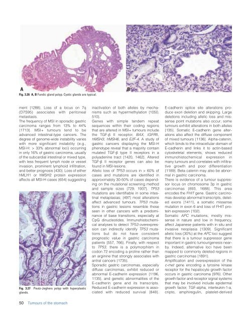 CHAPTER 3 Tumours of the Stomach - Pathology Outlines