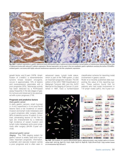 CHAPTER 3 Tumours of the Stomach - Pathology Outlines