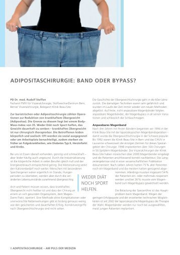 ADIPOSITASCHIRURGIE: BAND ODER BYPASS?
