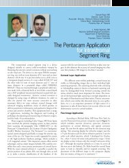 The Pentacam Application for Intrastromal Segment Ring - Oculus