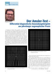 Der Amsler-Test – - Der Augenoptiker Benjamin Walther