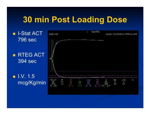 PowerPoint Presentation (PDF) - Perfusion.com