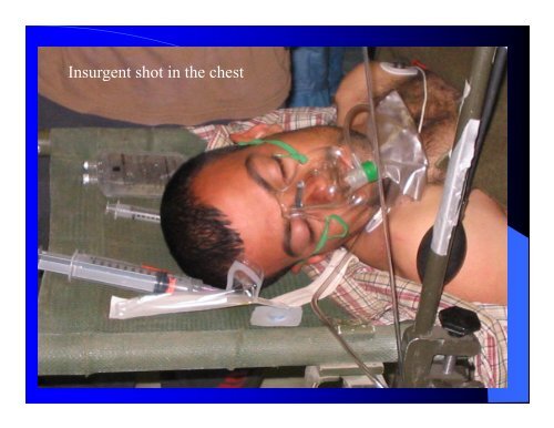 Operation Iraqi Freedom - Perfusion.com