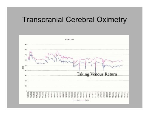 PowerPoint Presentation (PDF) - Perfusion.com