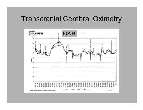 PowerPoint Presentation (PDF) - Perfusion.com