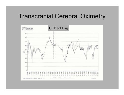 PowerPoint Presentation (PDF) - Perfusion.com