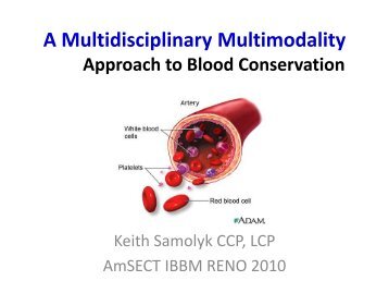 PowerPoint Presentation (PDF) - Perfusion.com