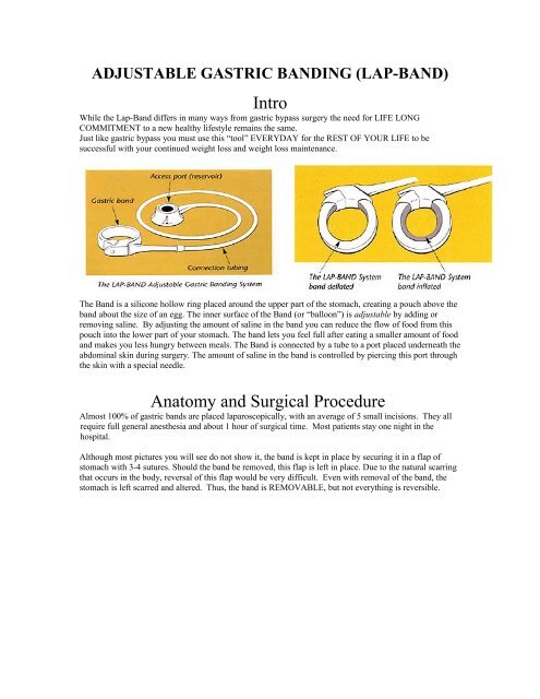 Patient Information Book For Gastric Bypass Surgery - permanente.net