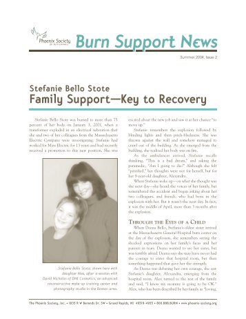 Stephanie Bello Stote - The Phoenix Society for Burn Survivors, Inc.