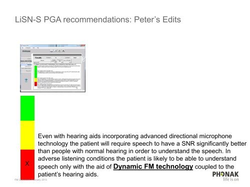 directional microphone technology - Phonak