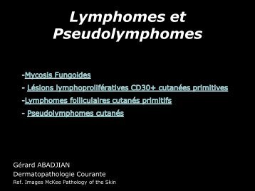 Lymphome centro-folliculaire primitif cutané - epathologies