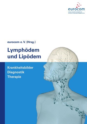 Lymphödem und Lipödem Krankheitsbilder Diagnostik - Eurocom