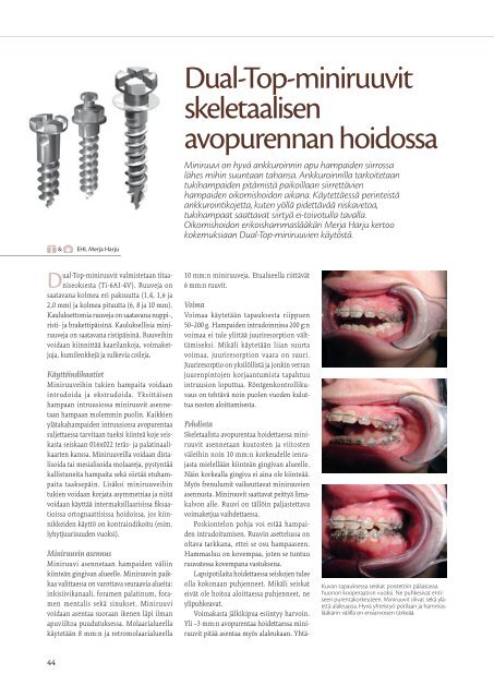 40-vuotias Plandent Oy