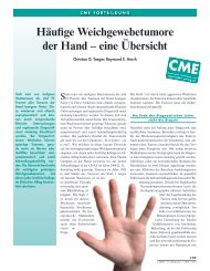 Weichgewebstumoren der Hand - Plastisch- und Handchirurgische ...