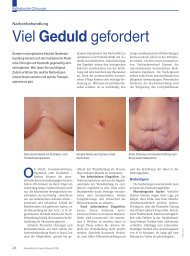 Viel Geduld gefordert - Plastische Chirurgie Dr. Reus