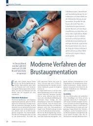 Brustaugmentation - Plastische Chirurgie Dr. Reus